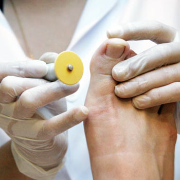 Podologia Preventiva em Santos