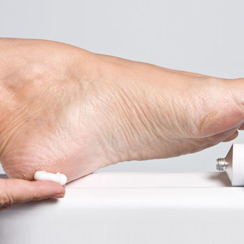 Tratamento de Pés com Rachaduras em Santos