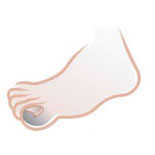 Tratamentos para os Pés em Santos