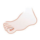 Tratamentos para os Pés em Santos